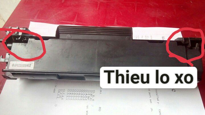 hop muc 85a in ra bi mo 1 benh